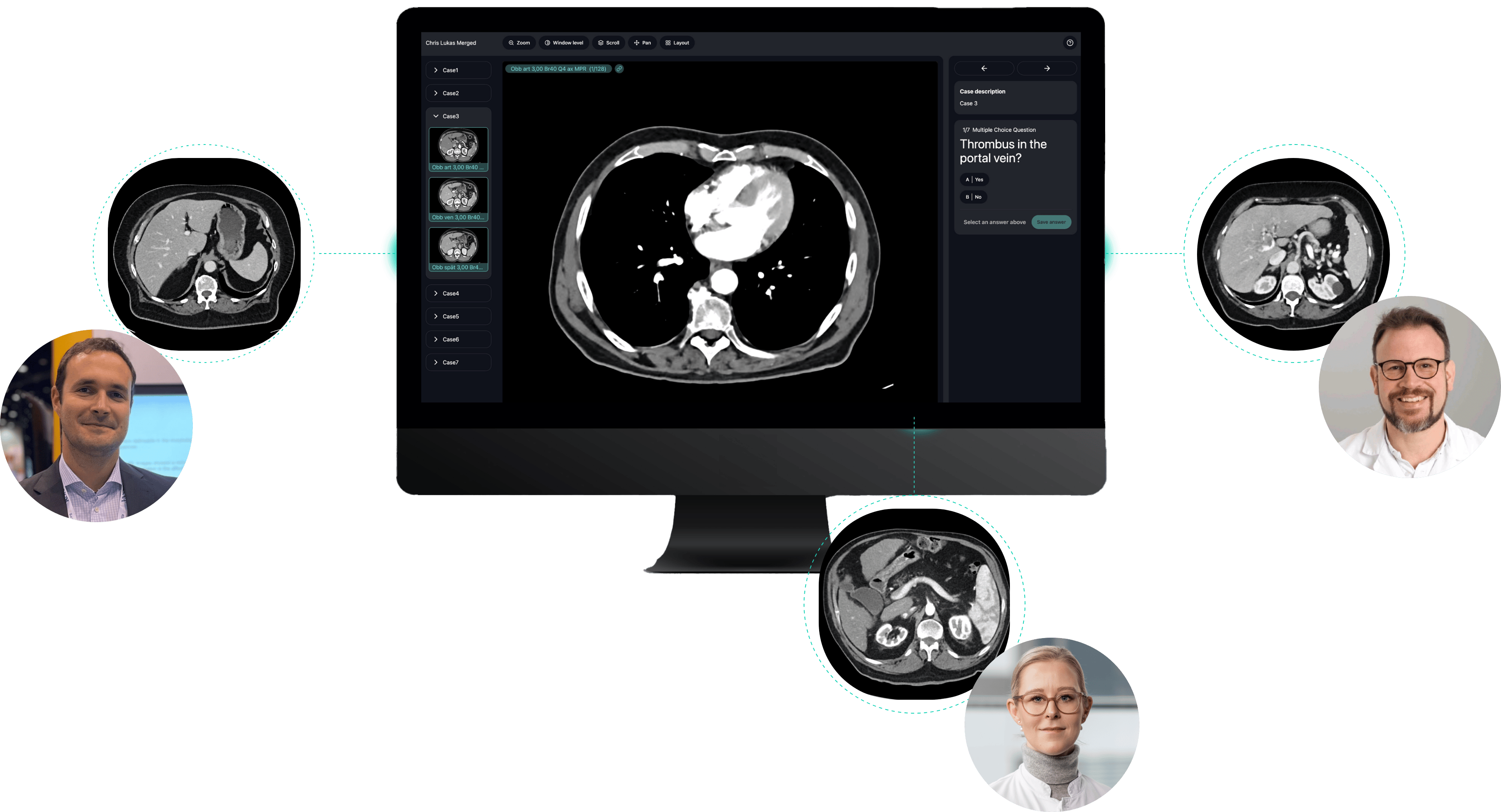 Three radiologists sharing CT scans in real time via the Rapmed platform, centered on a desktop displaying the DICOM viewer.