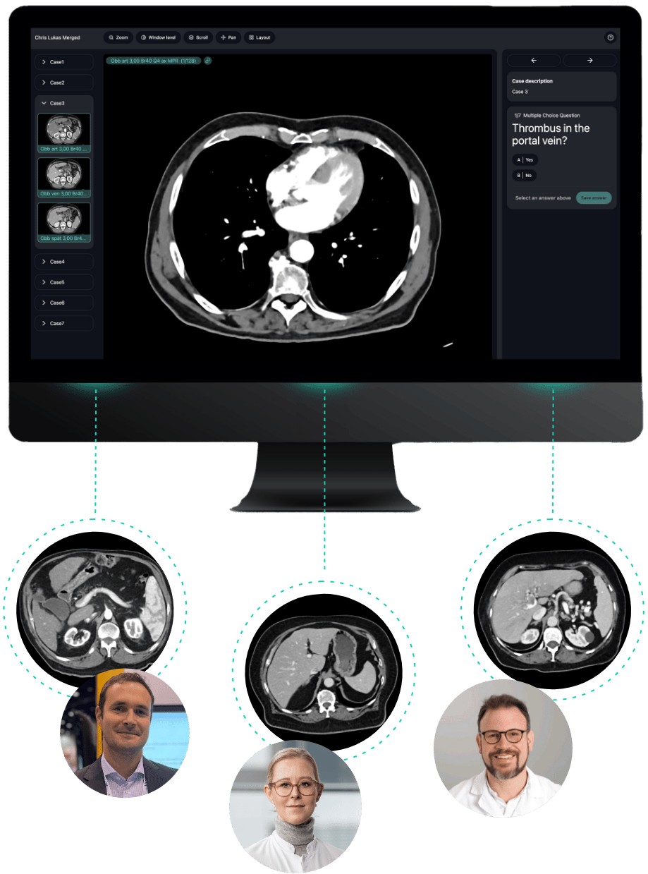 Three radiologists sharing CT scans in real time via the Rapmed platform, centered on a desktop displaying the DICOM viewer.