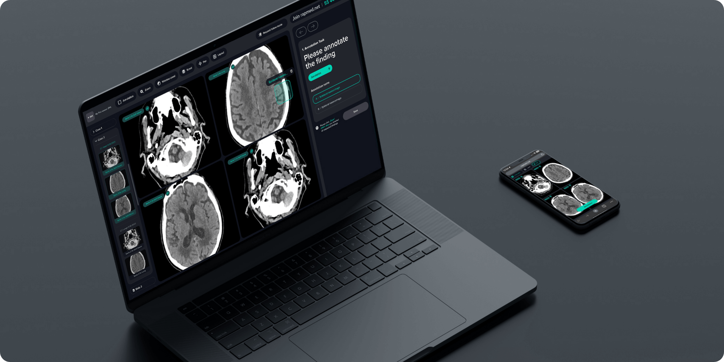 Desktop and smartphone side by side, both running Rapmed for seamless radiology collaboration on any device